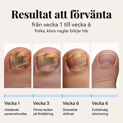 Caliora Förnyande Nagelsvampsplåster