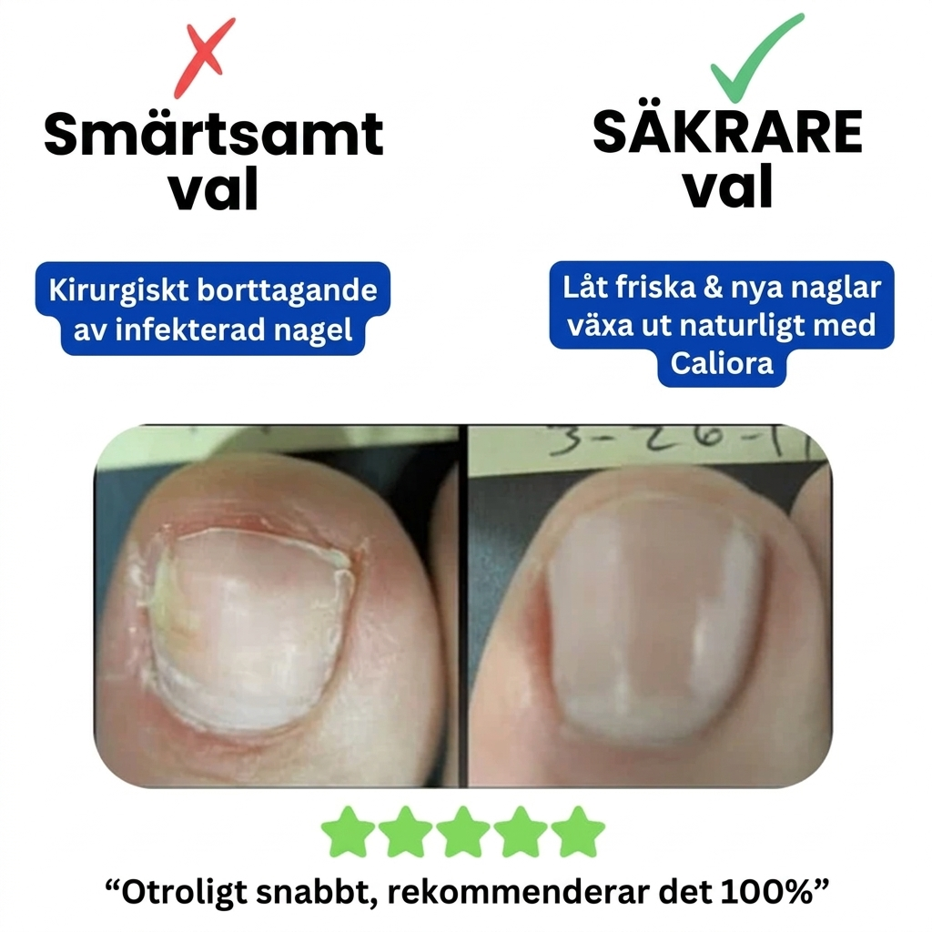 Caliora Förnyande Nagelsvampsplåster