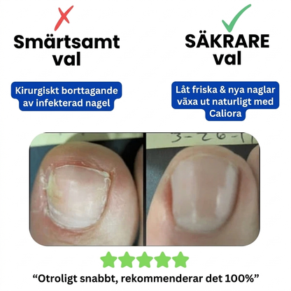 Caliora Förnyande Nagelsvampsplåster